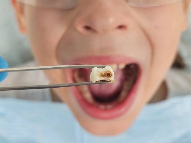 Best Emergency Denture Repair in Kent, OH
